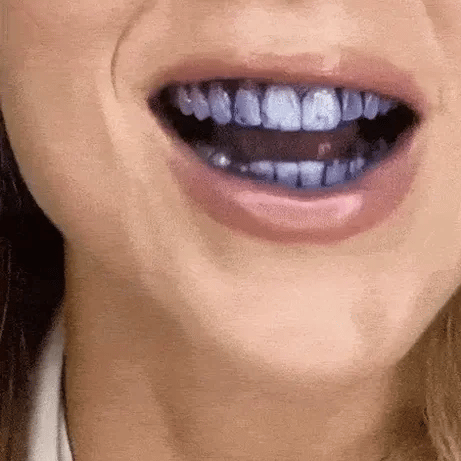 Hismile v34 Color Corrector Serum – Instant Teeth Whitening